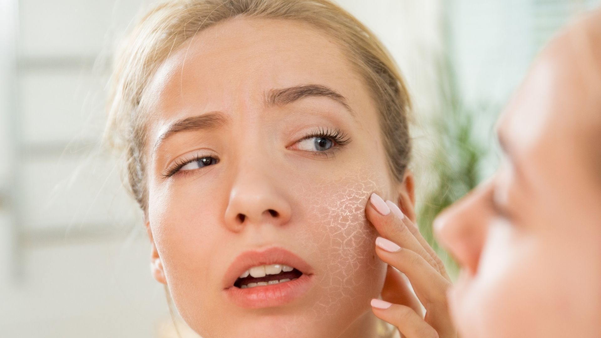 Лущиться шкіра на обличчі: причини, поради, як позбутися, профілактика — LAMBRE® Україна